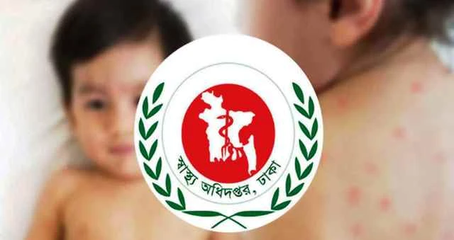 হাম ও উপসর্গ নিয়ে আরও ৬ জনের মৃত্যু