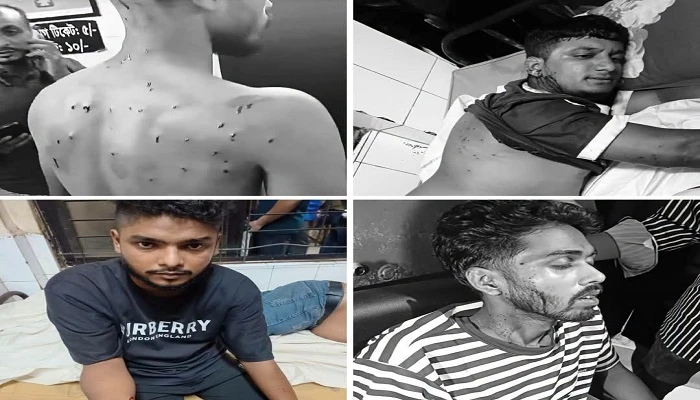 নোয়াখালীতে গায়ে হলুদে যাওয়ার পথে গুলিবিদ্ধ ৫